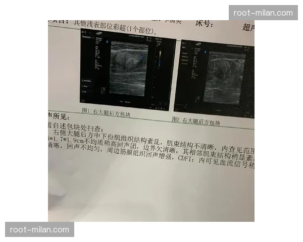 卡布拉尔肌肉轻微拉伤 中场替补深度受到一定影响